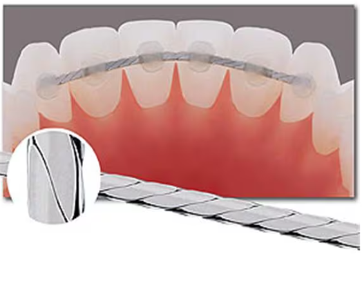 Flat Braided Archwire 6 in 10/Pk