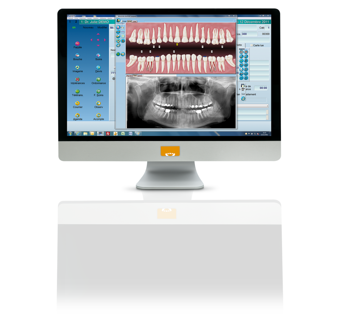 Cephalometric analysis and tracing module using A.I. (artificial intelligence)