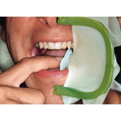 Fit-Plast-Frame – Plastic, Autoclavable