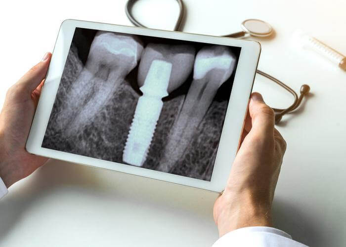 Digital Imaging – 3Z Dental