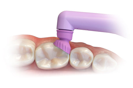 ProFlare™ Articulating Disposable Prophy Angle - Bag of 125 angles