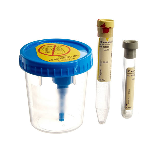 Vacutainer® Urine Collection Complete Kit
