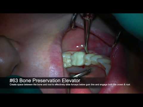 Spade Tip Bone Preservation Elevator – 4 mm Tip, Single End